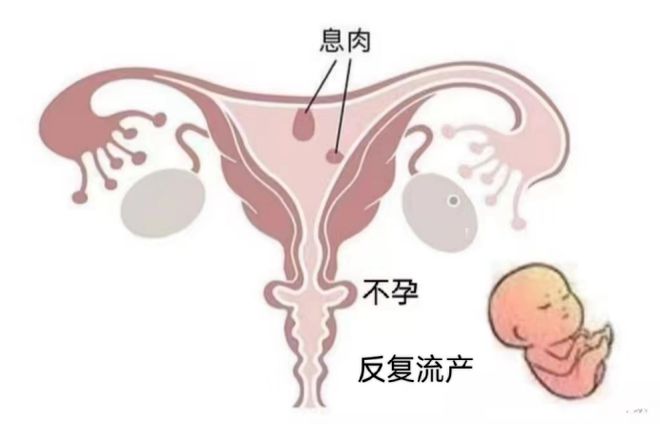 子宫切除半个月有血丝，术后恢复过程中的常见问题与注意事项