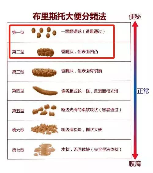 关于两个月宝宝拉大便有粘液的问题解析